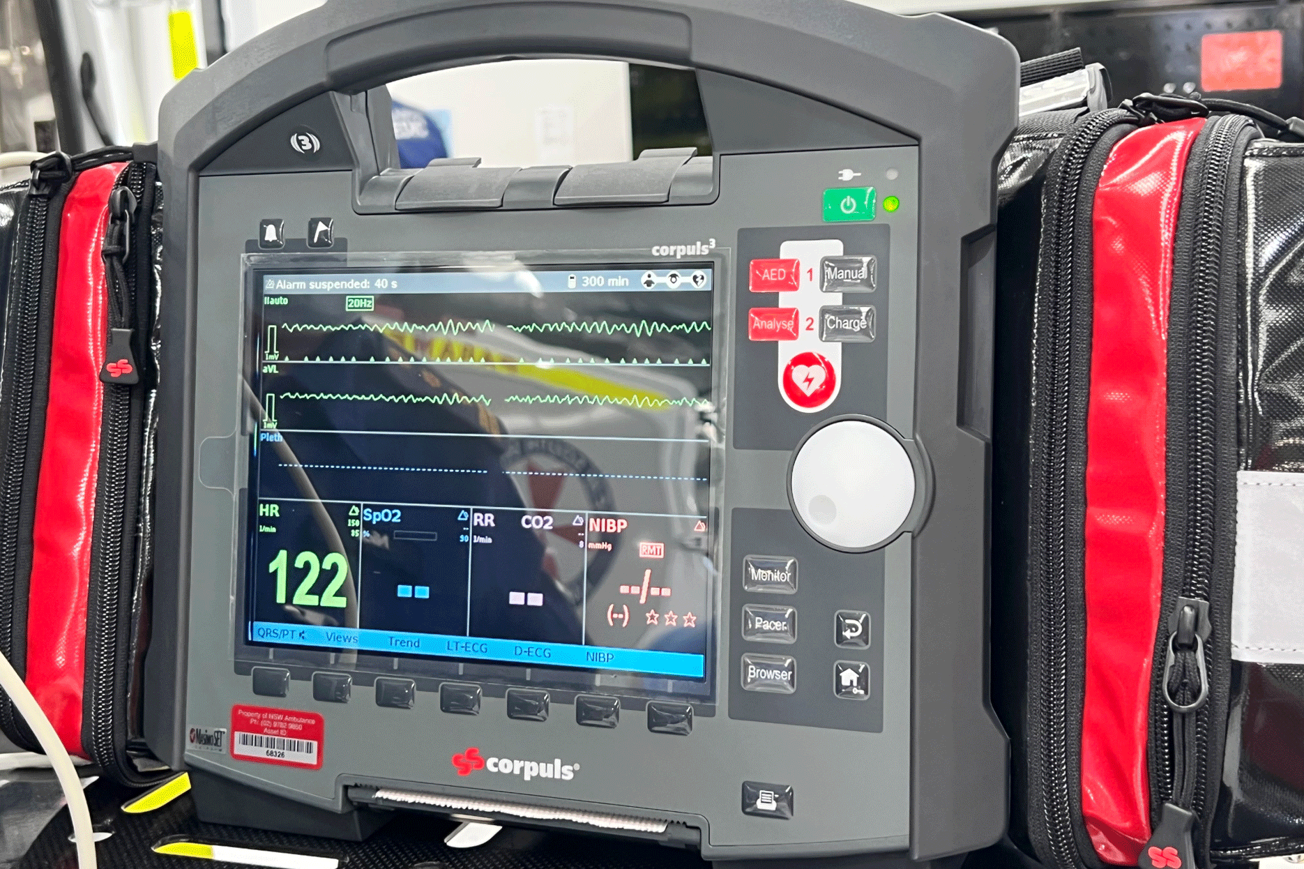 New cardiac monitor/defibrillator device.